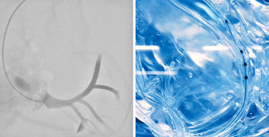 Lead implantation for coronary sinus and branches