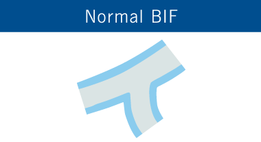 Normal BIF