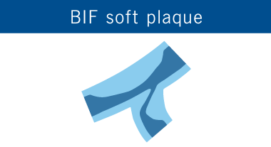 BIF soft plaque