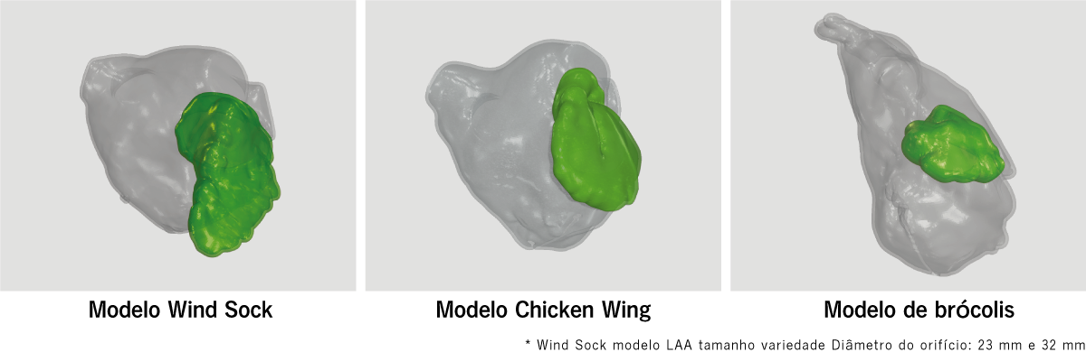 WindStock_ChickenWing_Broccoli-model