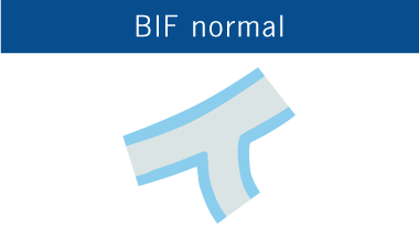 Normal BIF