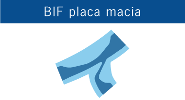 BIF soft plaque